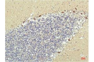 Immunohistochemical analysis of paraffin-embedded Human Brain Tissue using PPAR Delta Mouse mAb diluted at 1:200. (PPARD antibody)