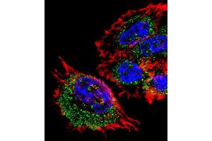 Fluorescent confocal image of A431 cell stained with MRPL28 Antibody (N-term) (ABIN1539254 and ABIN2838173). (MRPL28 antibody  (N-Term))