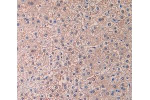 Used in DAB staining on fromalin fixed paraffin- embedded liver tissue (desert Hedgehog antibody  (AA 43-190))