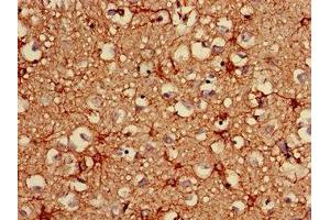 Immunohistochemistry of paraffin-embedded human brain tissue using ABIN7153847 at dilution of 1:100 (GFAP antibody  (AA 292-432))