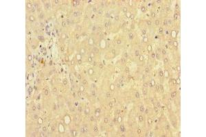 Immunohistochemistry of paraffin-embedded human liver tissue using ABIN7149462 at dilution of 1:100 (GLCE antibody  (AA 29-617))