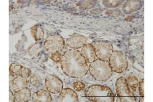 Immunoperoxidase of monoclonal antibody to TLN1 on formalin-fixed paraffin-embedded human small Intestine. (TLN1 antibody  (AA 1052-1149))