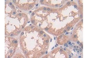 Detection of IL10 in Human Kidney Tissue using Polyclonal Antibody to Interleukin 10 (IL10) (IL-10 antibody  (AA 19-178))