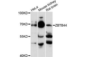 Western blot analysis of extracts of various cell lines, using ZBTB44 antibody (ABIN6291829) at 1:3000 dilution. (ZBTB44 antibody)