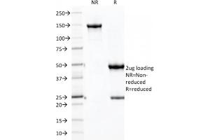 SDS-PAGE Analysis Purified CDH16 Mouse Monoclonal Antibody (CDH16/2125) (unconjugated). (Cadherin-16 antibody  (AA 371-507) (Biotin))