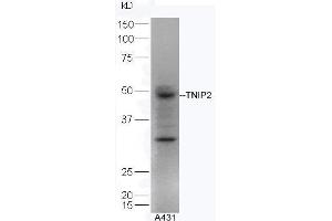 Human A431 lysates probed with Rabbit Anti-TNIP2 Polyclonal Antibody, Unconjugated  at 1:5000 for 90 min at 37˚C. (TNIP2 antibody  (AA 85-180))