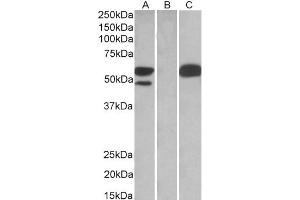 HEK293 lysate (10ug protein in RIPA buffer) overexpressing Human TRIM21 with C-terminal MYC tag probed with ABIN184965 (1ug/ml) in Lane A and probed with anti-MYC Tag (1/1000) in lane C.