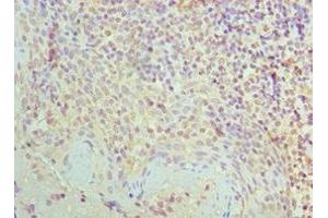 Immunohistochemistry of paraffin-embedded human tonsil tissue using ABIN7170857 at dilution of 1:100 (SMC1A antibody  (AA 1-130))