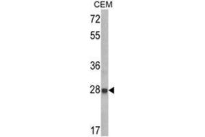 Western blot analysis of IGFBP6 Antibody (C-term) in CEM cell line lysates (35ug/lane). (IGFBP6 antibody  (C-Term))