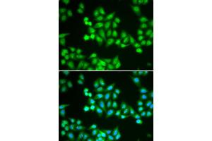 Immunofluorescence (IF) image for anti-Chromodomain Helicase DNA Binding Protein 2 (CHD2) antibody (ABIN1980262) (CHD2 antibody)