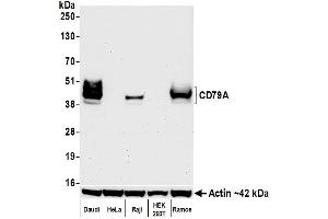 Western Blotting (WB) image for anti-B-cell antigen receptor complex-associated protein alpha chain (CD79A) (AA 176-226) antibody (ABIN7454005) (Recombinant CD79a antibody  (AA 176-226))