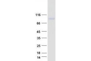 GIT1 Protein (GIT1) (Transcript Variant 2) (Myc-DYKDDDDK Tag)