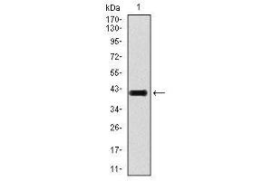 Image no. 2 for anti-Transforming Growth Factor, beta 1 (TGFB1) antibody (ABIN1491617) (TGFB1 antibody)
