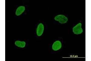 Immunofluorescence of monoclonal antibody to C15orf15 on HeLa cell. (RSL24D1 antibody  (AA 1-150))