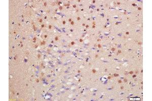 Formalin-fixed and paraffin embedded rat brain labeled with Anti-HDAC3/HD3 Polyclonal Antibody, Unconjugated  at 1:200 followed by conjugation to the secondary antibody and DAB staining (HDAC3 antibody  (AA 31-130))