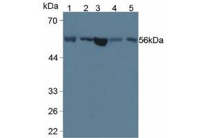 Figure. (LPCAT3 antibody  (AA 122-233))
