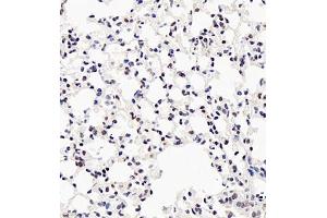 Immunohistochemistry (Paraffin-embedded Sections) (IHC (p)) image for anti-Ubiquitin Protein Ligase E3A (ube3a) antibody (ABIN7076105)