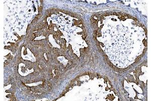 IHC analysis of TJP2/ZO2 using anti-TJP2/ZO2 antibody (ABIN7602800). (TJP2 antibody  (C-Term))