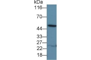 Detection of IL13Ra1 in Porcine Liver lysate using Polyclonal Antibody to Interleukin 13 Receptor Alpha 1 (IL13Ra1) (IL13 Receptor alpha 1 antibody  (AA 203-376))