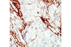 Immunohistochemistry (IHC) image for anti-Fibroblast Growth Factor Receptor 1 (FGFR1) (AA 19-48) antibody (ABIN3030945)