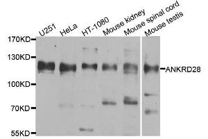 Western blot analysis of extracts of various cell lines, using ANKRD28 antibody. (ANKRD28 antibody  (AA 1-300))