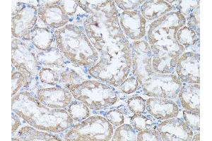 Immunohistochemistry of paraffin-embedded rat kidney using SNAI1 antibody. (SNAIL antibody  (AA 1-264))