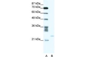 Western Blotting (WB) image for anti-BCL2-Related Protein A1 (BCL2A1) antibody (ABIN2463721) (BCL2A1 antibody)