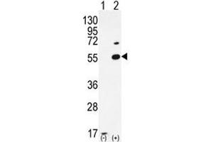 Western blot analysis of PRMT2 antibody and 293 cell lysate either nontransfected (Lane 1) or transiently transfected (2) with the PRMT2 gene. (PRMT2 antibody  (AA 22-53))
