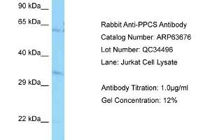 Western Blotting (WB) image for anti-Phosphopantothenoylcysteine Synthetase (PPCS) (N-Term) antibody (ABIN2789587) (PPCS antibody  (N-Term))