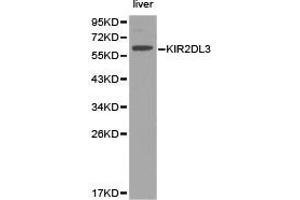 Western Blotting (WB) image for anti-Killer Cell Immunoglobulin-Like Receptor, Two Domains, Long Cytoplasmic Tail, 3 (KIR2DL3) antibody (ABIN1873416) (KIR2DL3 antibody)