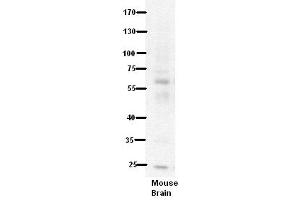 WB Suggested Anti-PDE9A Antibody Titration:  5% Milk  ELISA Titer:  dilution: 1:500  Positive Control:  Mouse Brain lysate (PDE9A antibody  (N-Term))