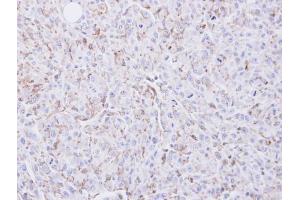 IHC-P Image Immunohistochemical analysis of paraffin-embedded U87 xenograft, using COX2, antibody at 1:100 dilution. (PTGS2 antibody  (C-Term))