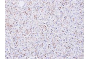 IHC-P Image Immunohistochemical analysis of paraffin-embedded U87 xenograft, using COX2, antibody at 1:100 dilution. (PTGS2 antibody  (C-Term))