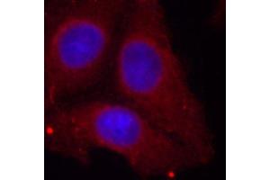 Immunofluorescence staining of methanol-fixed Hela cells using Phospho-GAP43-S41 antibody.