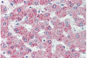 Liver, Human: Formalin-Fixed, Paraffin-Embedded (FFPE) (GPR146 antibody  (Internal Region))