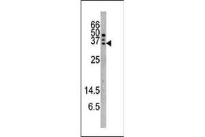 Image no. 1 for anti-Caspase 6, Apoptosis-Related Cysteine Peptidase (CASP6) (pSer257) antibody (ABIN358091) (Caspase 6 antibody  (pSer257))