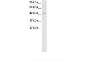 Image no. 2 for anti-Lymphoid Enhancer-Binding Factor 1 (LEF1) (AA 282-331) antibody (ABIN202428) (LEF1 antibody  (AA 282-331))