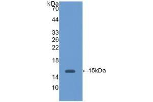 Detection of Recombinant HEXb, Mouse using Polyclonal Antibody to Hexosaminidase B Beta (HEXb) (HEXB antibody  (AA 101-217))