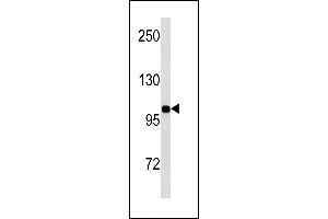 INSR Antibody (N-term) (ABIN1881461 and ABIN2843249) western blot analysis in MDA-M cell line lysates (35 μg/lane).