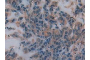 Immunohistochemistry (IHC) image for anti-Complement Decay-Accelerating Factor (CD55) (AA 35-285) antibody (ABIN7431821)