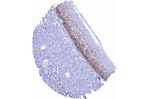 In squamous epithelium occludin positivity is regularly seen but staining is reduced or absent in basal and superficial cell layers scaled (Occludin antibody  (AA 282-415))