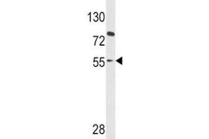 Western blot analysis of PAX8 antibody and HL-60 lysate (PAX8 antibody  (AA 285-313))