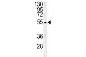 Beta III Tubulin antibody western blot analysis in HepG2 lysate (TUBB3 antibody  (AA 36-63))