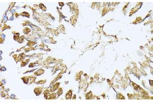 Immunohistochemistry of paraffin-embedded Rat testis using PSMA7 Polyclonal Antibody at dilution of 1:100 (40x lens).