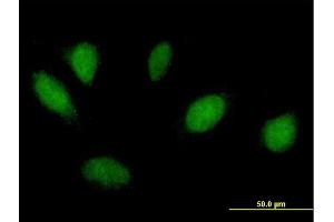Immunofluorescence of purified MaxPab antibody to MSX1 on HeLa cell. (MSX1 antibody  (AA 1-297))
