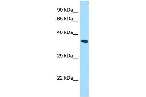 WB Suggested Anti-STARD7 Antibody Titration: 1. (STARD7 antibody  (N-Term))