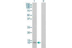 Western Blot analysis of APOC1 expression in transfected 293T cell line by APOC1 monoclonal antibody (M01), clone 2E2-1A3. (APOC1 antibody  (AA 1-83))