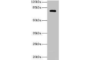 Western blot All lanes: MON1A antibody at 2 μg/mL + U251 whole cell lysate Secondary Goat polyclonal to rabbit IgG at 1/10000 dilution Predicted band size: 73, 45, 34, 56, 63 kDa Observed band size: 73 kDa (MON1A antibody  (AA 205-555))