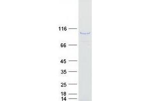 Western Blotting (WB) image for A Kinase (PRKA) Anchor Protein 8-Like (AKAP8L) protein (Myc-DYKDDDDK Tag) (ABIN2714494)
