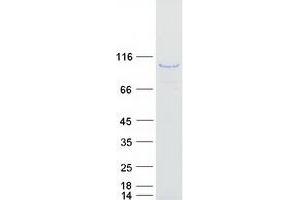 AKAP8L Protein (Myc-DYKDDDDK Tag)